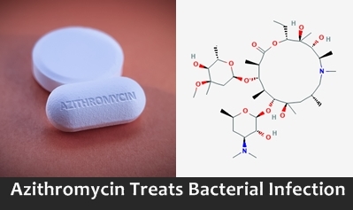 Azithromycin is an antibiotic that ceases the growth of bacteria and treats infections