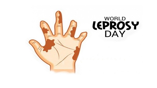 World Leprosy Day– 31st January 2021