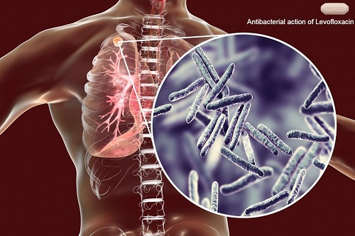 Dosage & Side Effects of Levofloxacin