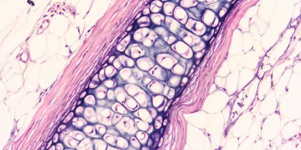 Chondroitin - effective in fighting Osteoarthritis