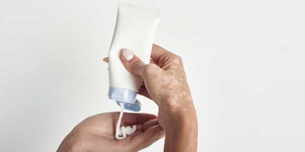 Methoxsalen – Treating Vitiligo and Psoriasis