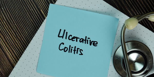 Role of Mesalazine in treating ulcerative colitis