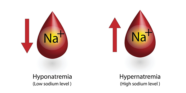 Treat hyponatremia with Tolvaptan