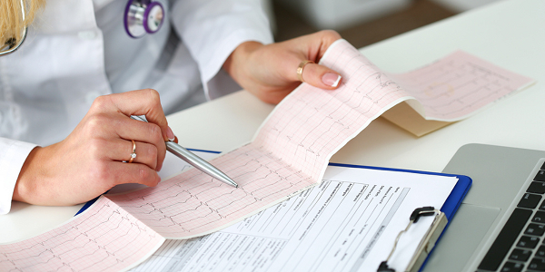 Amiodarone HCL – A closer look into its use in treating irregular heartbeat and its side effects