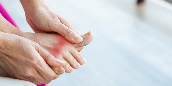 Managing Gout with Febuxostat: Dosage & Side Effects